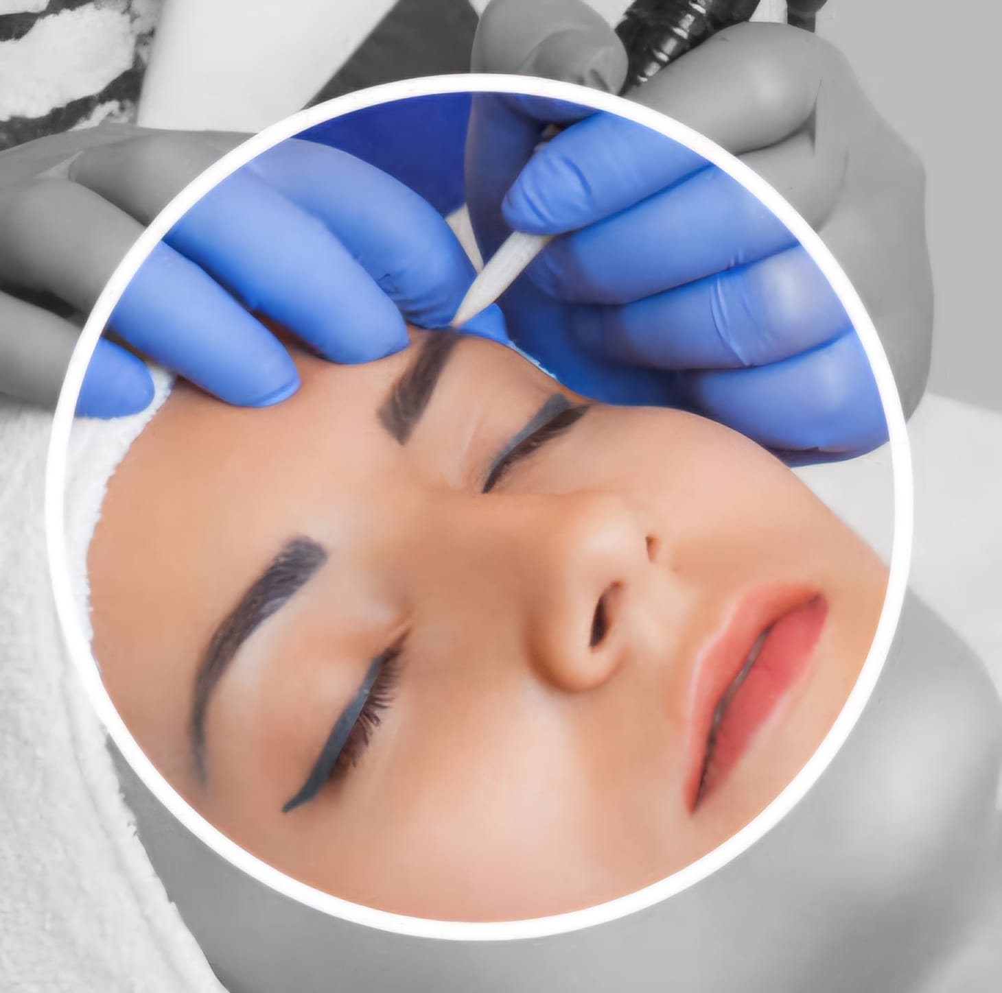 BB Remover Entfernung