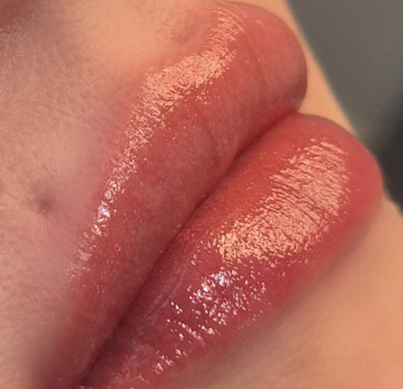 Lippen Pigmentierung